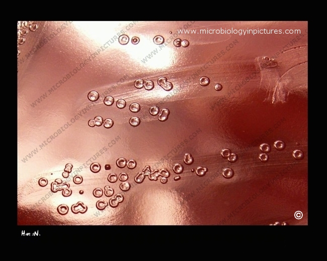 colonies of pneumococcus with depressed centers